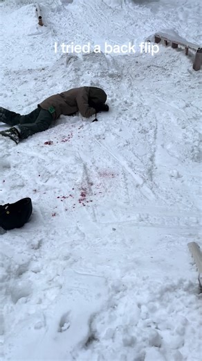 Hilarious Ski Fails: A Back Flip Gone Wrong