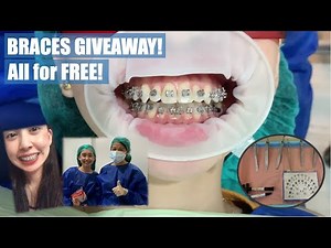 Free Braces (plus step by step procedure) | Smile of Hope Contest | Apostol Dental Philippines