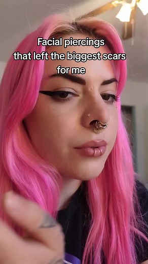 I love my piercing scars! ❤️ every one shows a different time period in my life #piercing #bridgepiercing #dermalpiercing #scars #fyp