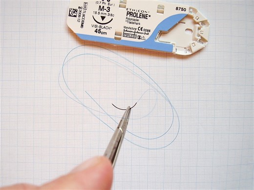 Stitches or Sutures: Wound Closure Today and in History