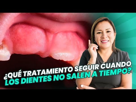 🤔🦷 Delayed Tooth Eruption: Why Do Teeth Take So Long to Erupt?