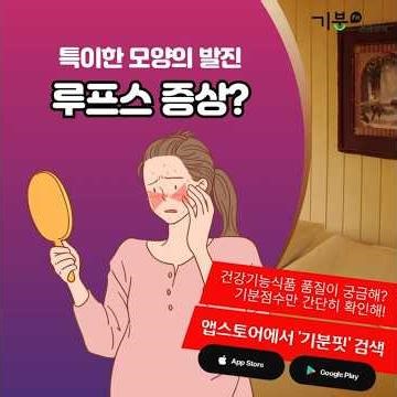 영상 특이한 모양의 발진 루프스 증상일까 #루프스 #루푸스 #자가면역질환 #나비모양발진 #관절염 #염증에좋은음식 #솔라닌 #루프스식단 #만성피로 #건강정보