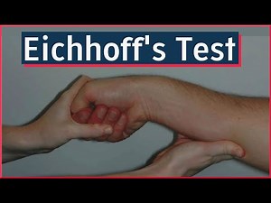 Eichhoff's Test | De Quervain's Tenosynovitis