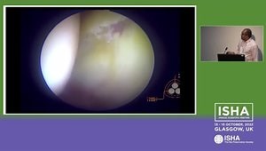 AMIC Labral Reconstruction / Augmentation