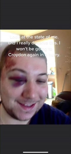 In my opinion this wasn’t deserved!!! What do you think guys? #comedy #british #britishhumour #croydon #xyzbca #fighter #prank #pranks #prankster #fyp #foryou #foryoupage