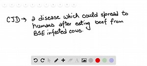 SOLVED:Prions are responsible for variant CJD (Creutzfeldt Jakob Disease). How has this disease been documented to spread from human to human? a. Surgery with instruments previously used in a patient with vCJD that were not adequately sterilized and contaminated pineal growth hormones taken from human pineal glands from infected cadavers. b. Through human consumption of infected meat and contaminated pituitary growth hormones taken from human pituitary glands from infected cadavers. c. Surgery w