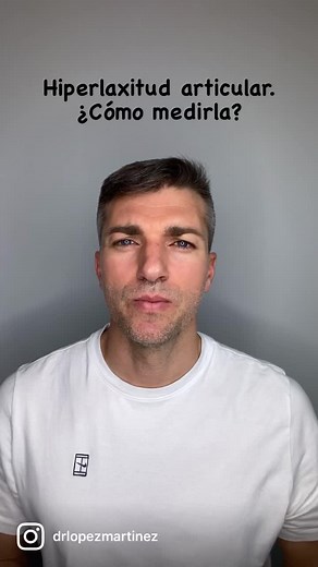 Hiperlaxitud articular: ¿Cuánto puntaje tienes?