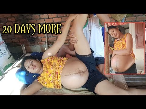 ASMR massage /How to treat numbness , (Improve mom pregnant health by massage)-130