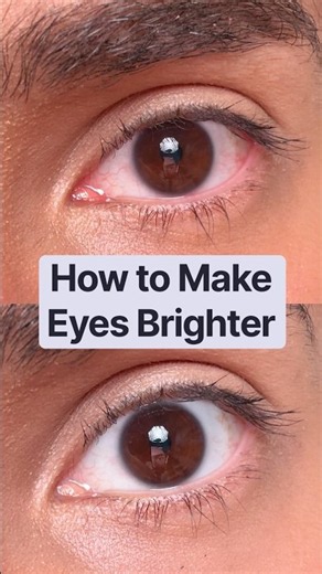 How to Brighten Up Eyes #lumify #whiteeyes #eyeredness