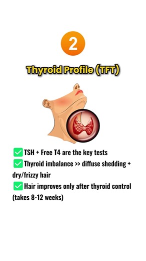 5 Blood Tests For Hairfall #HairFallSolution, #HairLossTreatment, #HairFalltest