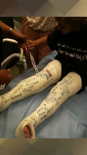 Cast Removal from Two Legs with Little Boy