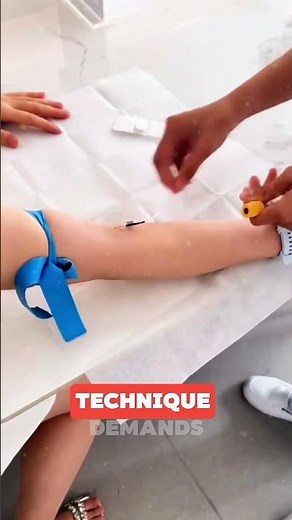 Mastering the Flying Needle Technique ⚡🎯