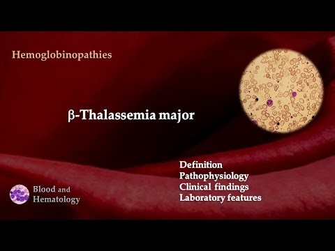 Beta-Thalassemia Major