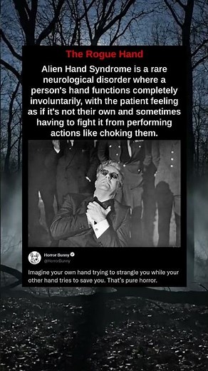 Alien Hand Syndrome is a rare neurological disorder where a person's hand functions completely