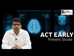 Stroke Explained: Types, Causes & How to Prevent It | Dr. Biswaranjan Nayak | 2050 Health Care