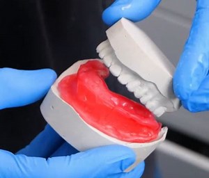 8.5K views · 28 reactions | Processi affascinanti di creazione di protesi dentarie rimovibili! | 5 Minuti Creativi | Facebook