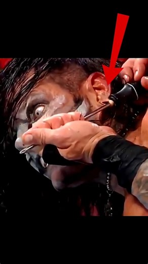 Why Randy Orton Treat Jeff Hardy Eyer Brutally?😨😱#wwe #shorts #short
