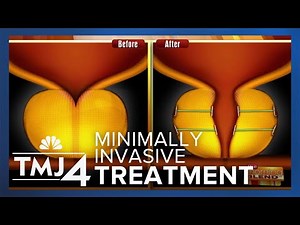 A breakthrough treatment for men with enlarged prostates