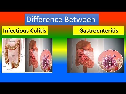 Difference Between infectious Colitis And Gastroenteritis
