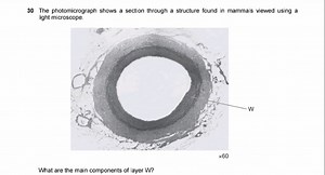 Question:The photomicrograph shows a section through a structu... | Filo