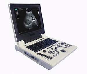 [Hot Item] Medical Best Cheapest Ultrasound Scan Equipment Echo Machine