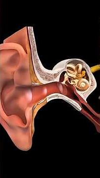 Ear Tube Placement (Tympanostomy Tubes) – 3D Animation Explained #shorts #shortvideo #shortsfeed #yt