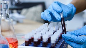 Life-saving new sepsis test has '100% match rate' with results in record time