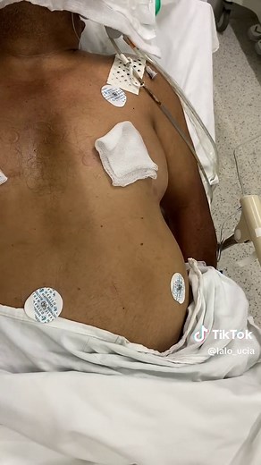 Colocación de Electrodos para Monitorización Cardíaca