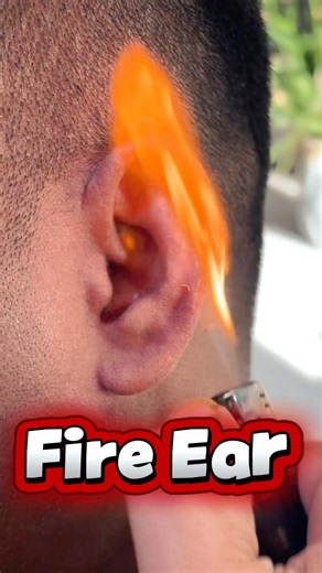 ASMR Ear Wax Removal 🔥 Fire Candling Treatment | Satisfying Sounds [No Talking]