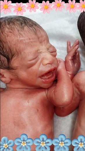 Adorable Twin Newborn Babies First Cry Immediately After Birth