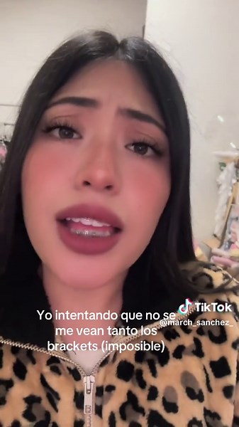 Cómo ocultar los brackets: un desafío imposible