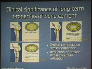 Bone cement and cementing techniques - Prof. Foad Zamel By D. Mohamed Abo Elsoaud