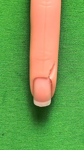 4.9M views · 10K reactions | ✅El punto simple es la base de toda sutura ✅Se realiza pasando la aguja de un lado al otro de la herida, asegurando un cierre firme y preciso ✅Su correcta ejecución es clave para una buena cicatrización y menor riesgo de complicaciones | Doctor.sutura | Facebook