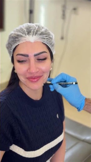 5-Star Experience ⭐ Thread Lift Review by Sunia Sundas | Dr Salman