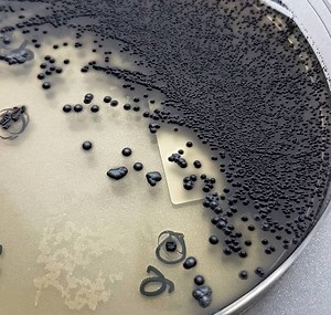 Tinsdale Agar: Composition, Preparation, Uses • Microbe Online