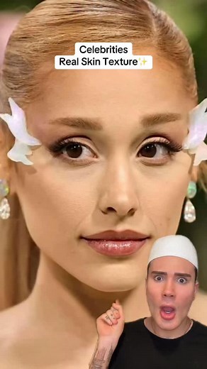 Normalizing skin texture!🥰 #skintexture #largepores #pores #blackheads #acneproneskin #acnepositivity #skincaregoals #skincareregimen #skincarelover | Matt Randon