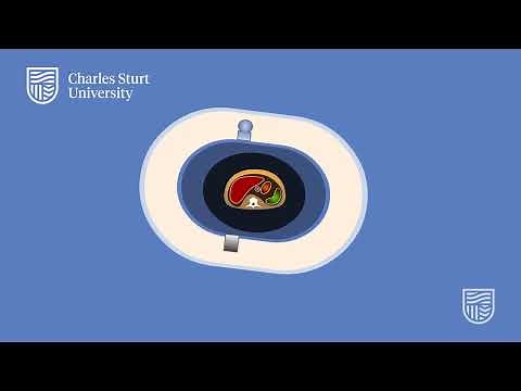 First Generation CT: Rotate/Translate with pencil beam