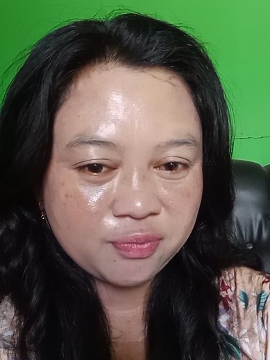 #fyp #pejuangflekhitam😭😭😭 #membandel