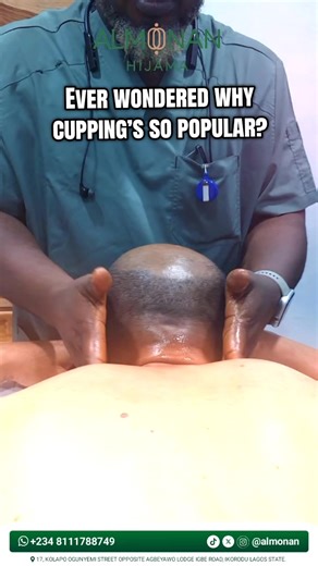Discover the Secret Benefits of Cupping Therapy