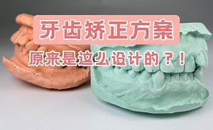 揭秘smilelab笑盈矫正方案的幕后