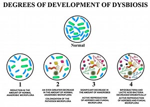 Dysbiosis and Aging