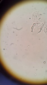 2K views · 97 reactions | The video shows a 40x microscope...