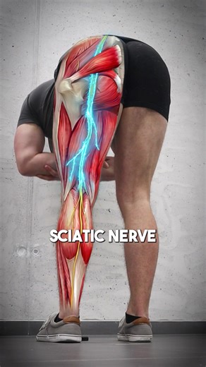 Easy Steps to Relieve Sciatica Pain Effectively
