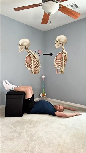 Fix Kyphosis at Home | 4 Gentle Exercises to Improve Rounded Upper Back