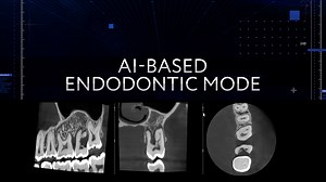 1.4K views · 26 reactions | Why choose Planmeca Viso®? 樂 Planmeca Viso CBCT units offer high-precision imaging for even the most demanding endodontic needs. Our AI-based 3D endodontic imaging mode combats noise and allows capturing clear and smooth CBCT images that are perfect for endodontics. ✨ #planmeca #planmecaviso #whychooseviso #dental #dentistry #digitaldentistry #wearedigitaldentistry #dentaltech #imaging #CBCT #endodontics | Planmeca | Facebook