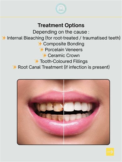 Single Tooth Turning Brown/Black? Don’t Ignore This Warning Sign! Dr Patel | Kalyan #dentistinkalyan