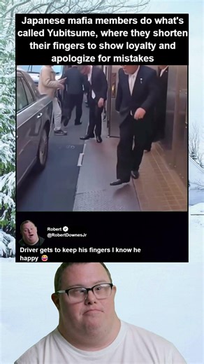 Mafia Members In Japan Who Practice Yubitsume