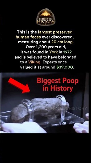 Biggest Poop In History #shorts