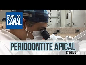 Video 7 - Periodontite Apical - parte 2
