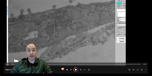 Walk through of Live Vero Cell Culture Microscopy